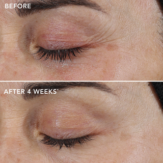 AGELESS+ retinol repair crème 0.3% retinol complex