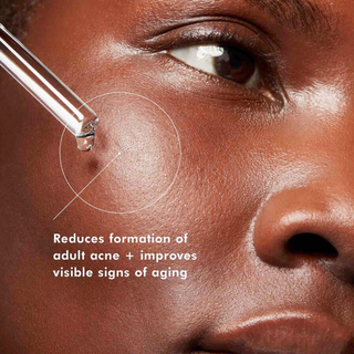 Blemish + Age Defense