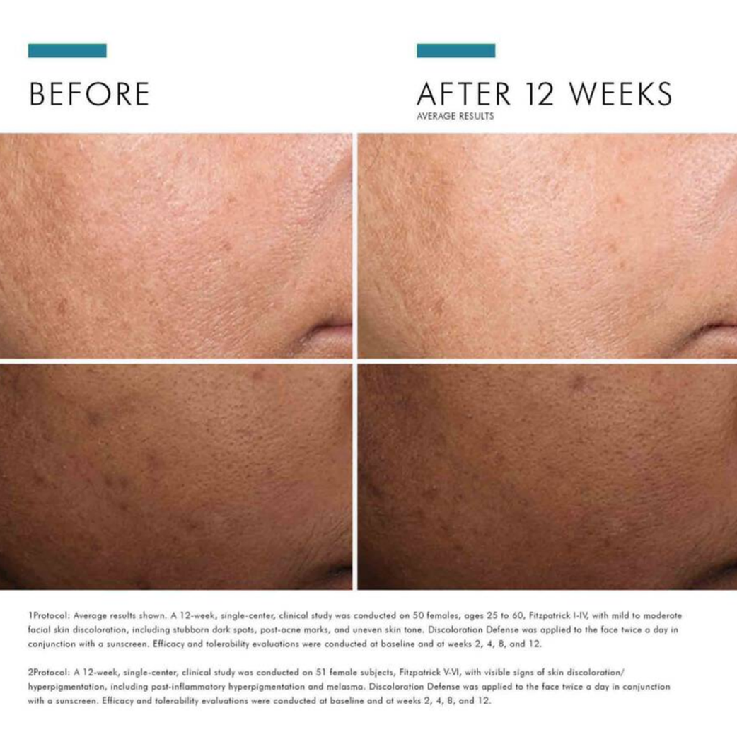 Discoloration Defense