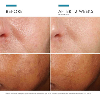 Phloretin CF with Ferulic Acid