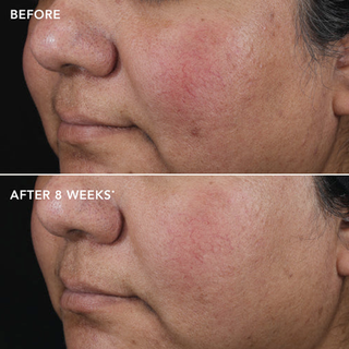 AGELESS+ retinol pure liquid retinol 0.75%