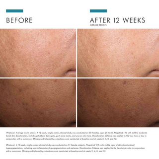 Discoloration Defense