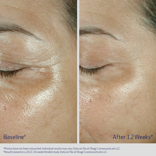Eye Cream for Fine Lines & Wrinkles