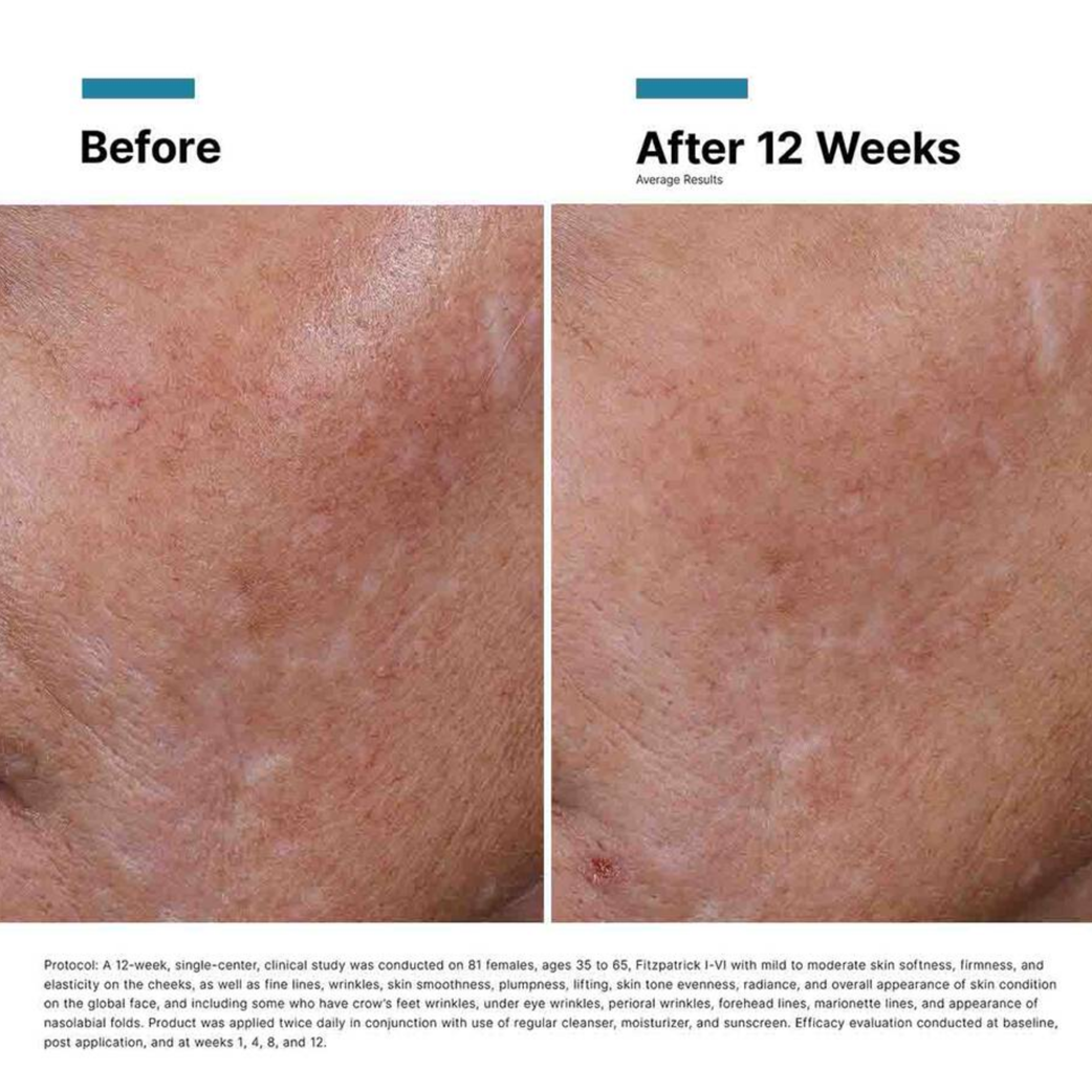 Hyaluronic Acid Intensifier Multi-Glycan
