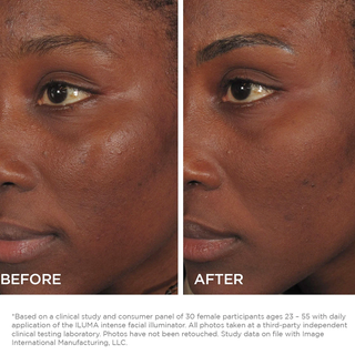 LUMA intense facial illuminator