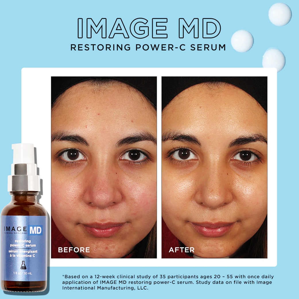 IMAGE MD® restoring power-C serum