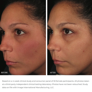 ORMEDIC balancing antioxidant serum