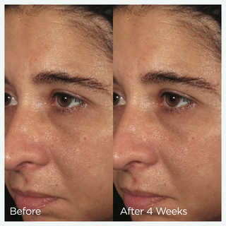 ORMEDIC balancing biopeptide crème