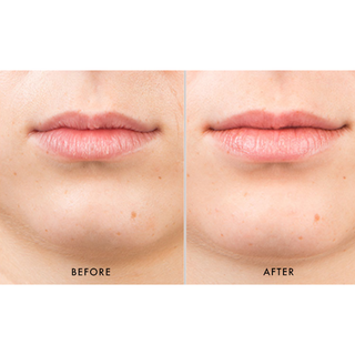 SkinMedica HA5 Smooth and Plump Lip System (2 piece)