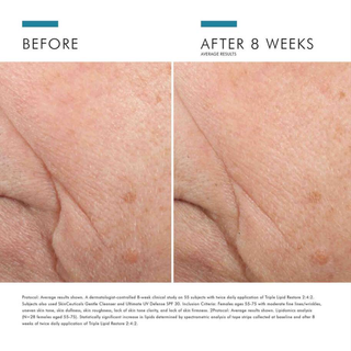 Triple Lipid Restore 2:4:2